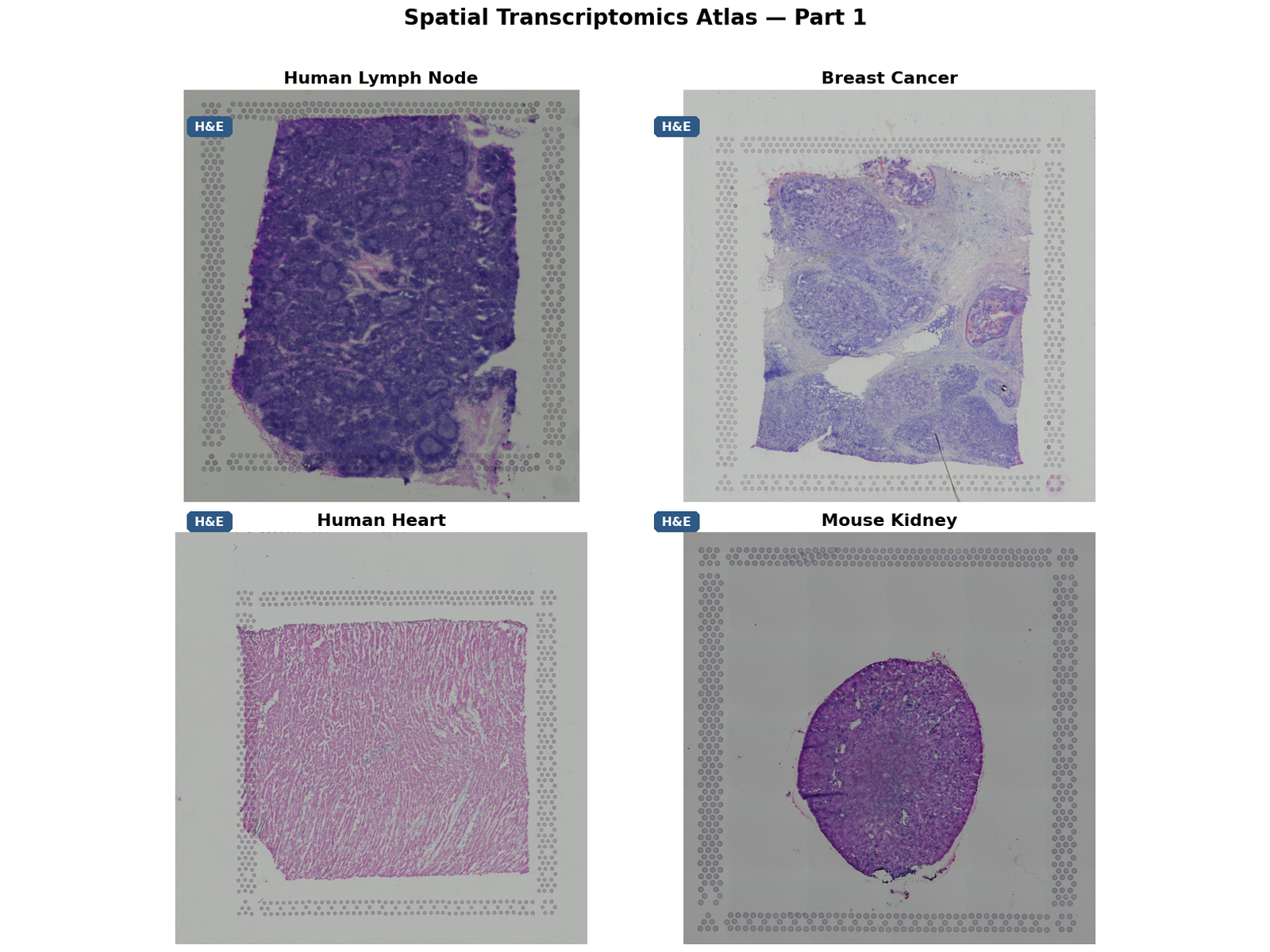 Multi-tissue atlas annotated view
