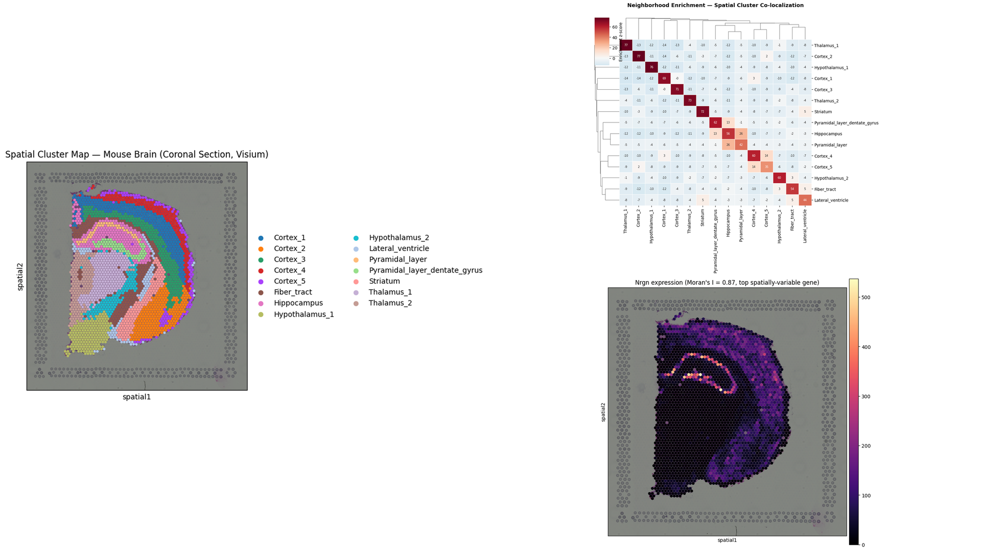 Spatial transcriptomics analysis output